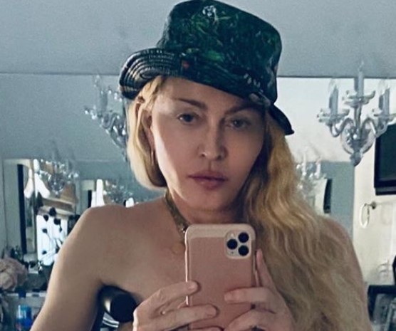 Madame X, Madonna Goes Topless for a Selfie with Crutch; Fans turns Frenzy