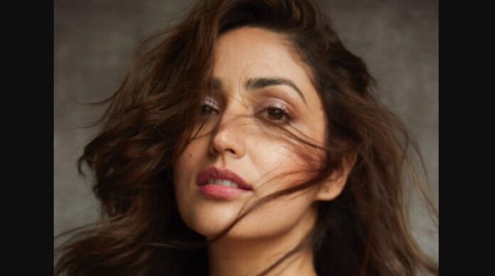 I was blown away by the response to my ailment post -Yami Gautam